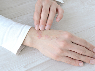 肌荒れをきにする人